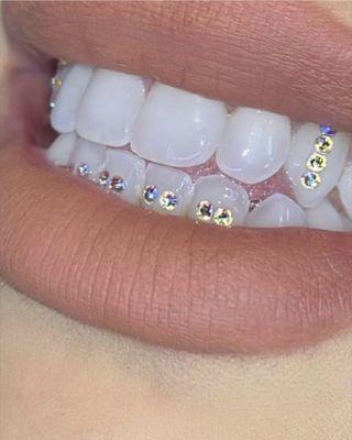 Teeth Gems