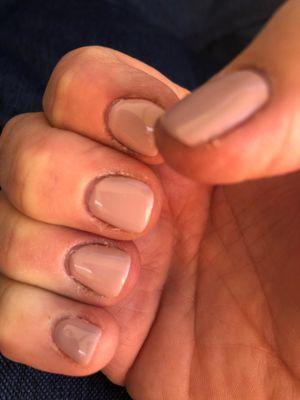 Poor manicure