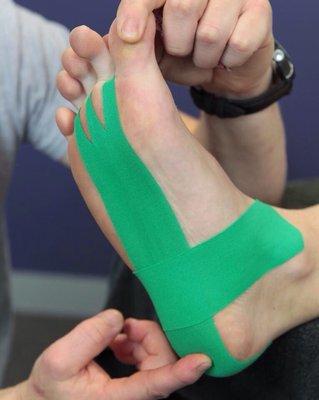 Athletic tape for Plantar Fasciitis.