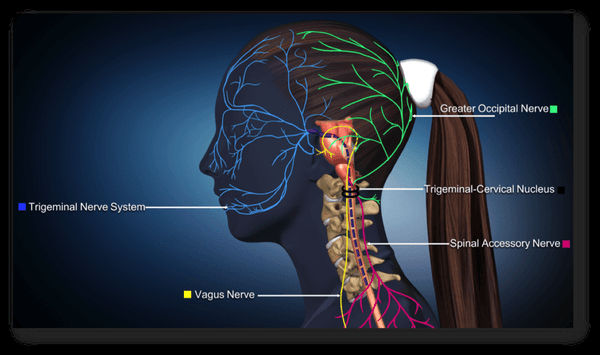 Frequently, headache and migraine symptoms are the result of nerve impingements in the neck.