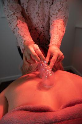 Acupuncture includes Cupping