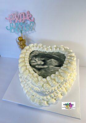 Gender reveal sonogram heart shaped cake