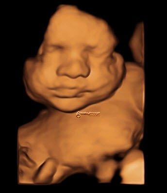 Baby Image 3D-4D Ultrasound