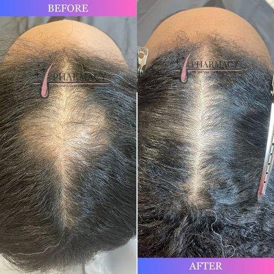 Hair Treatment - Before & After