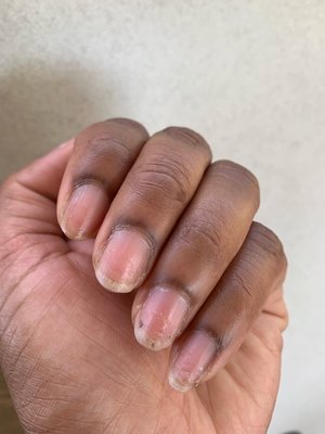 Nails after gel manicure. After shaving my nails there are two different textures .