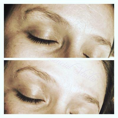 Brow shaping