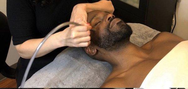 Men's Microdermabrasion