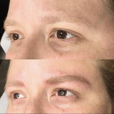 After my first and second sessions of microblading.