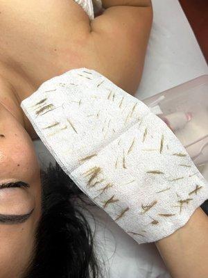 Dermaplane Facial