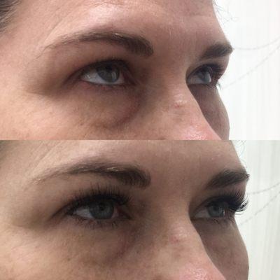 Individual Eyelash Extension