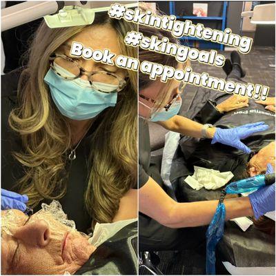 skin tightening