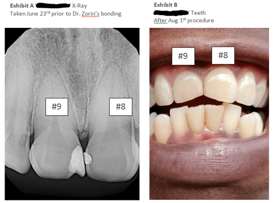 Dr. Oleg Zorin DDS ruined my teeth.