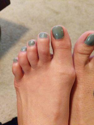 Gel pedicure