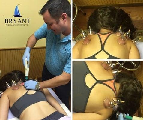 Dr. Michael Fontenot is seen here using a combination of dry needling and cupping therapy to help jumpstart the bodies natura...