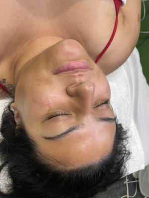 After of our Be You Custom Facial focusing on dryness.