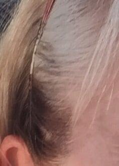 Dark shadow high up above right ear vs white hair at same height on left ear.