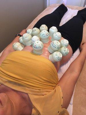 Abdominal cupping amazing for tummy tension!