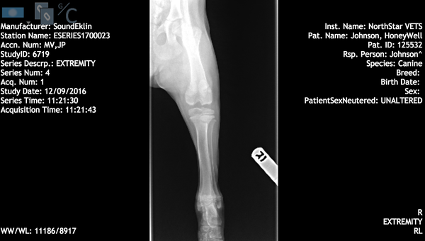 Honey's x-ray at 4 month showing osteochondritis dissecans.