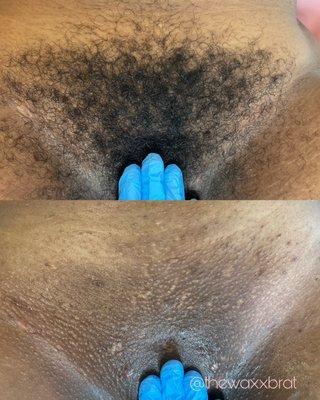 Brazilian Wax