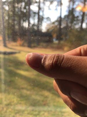 Acrylic still covering half my nail after I had them removed.