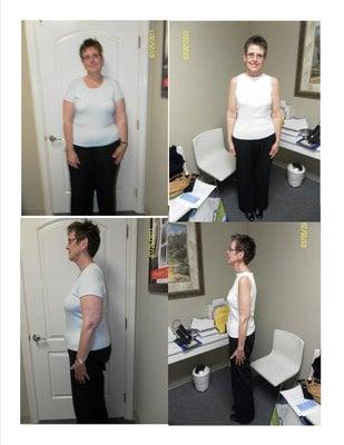 Clara Lost 75lbs!