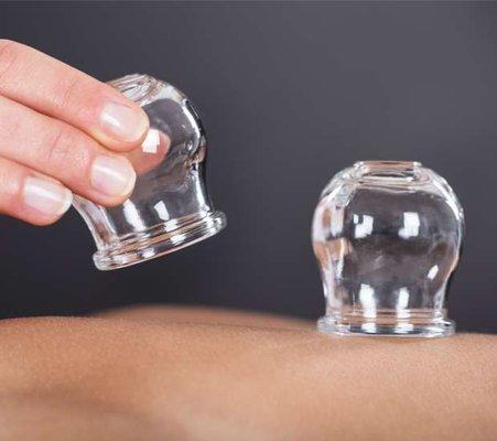 Advanced Health Center | Integrative & Functional Medicine Kind Acupuncturist Cupping Therapy Arlington Alexandria Virginia Washington DC