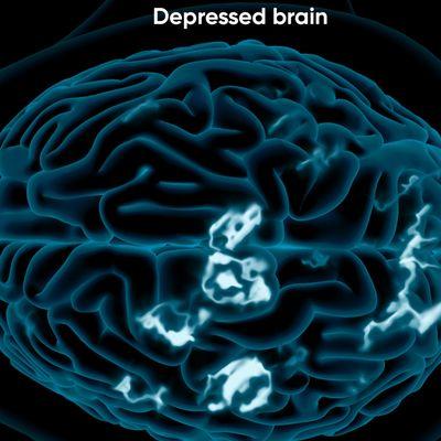 Depressed Brain