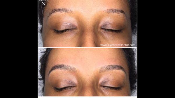 Micro blading