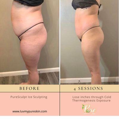 PureSculpt wood and ice contouring treatments