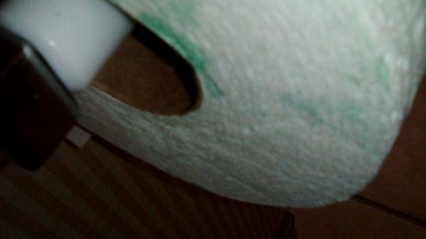 Black pubic hair sticking out of the inner tubbing of the roll on the bottom right u can see it. Gross wtf?! Discusting.