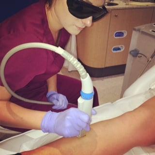 Talia performing laser hair removal