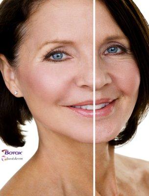 Look 5 years younger TODAY! Ask us how. Come in for a no charge consultation today!