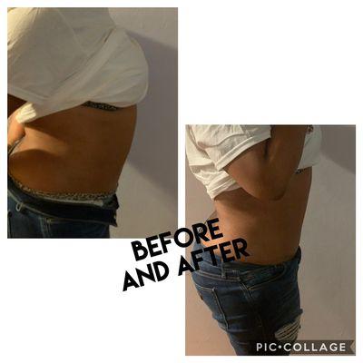 Loose one inch in one hour !! Body Contouring Session