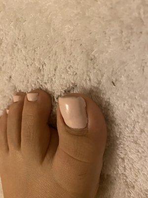 Horrible pedicure, overlay hot mess