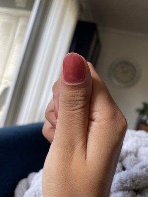 Nail edge is uneven