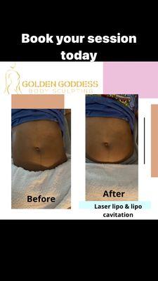 Golden Goddess Body Sculpting