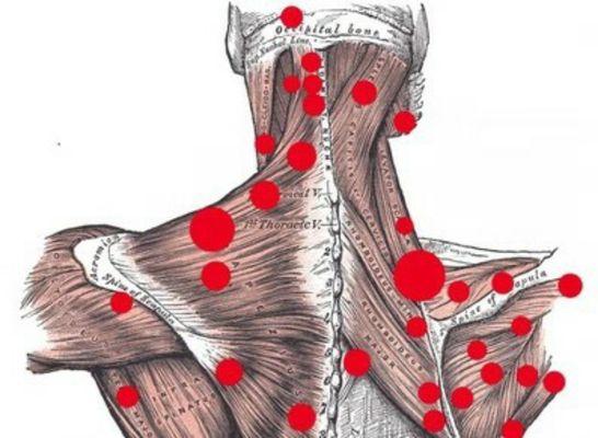 When you have neck pain and shoulder  pain .we can give you do some trigger points to help reduce your  pain and tension muscles