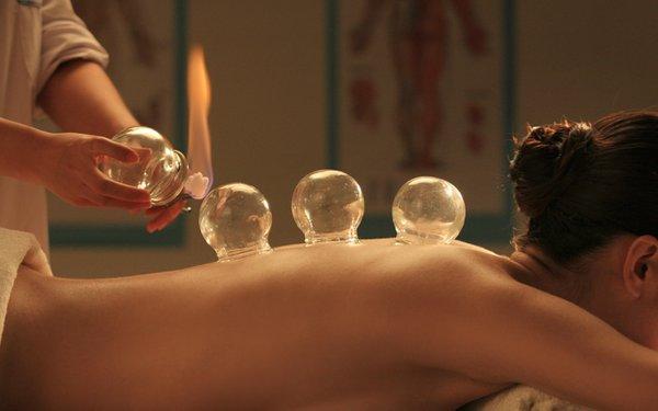 Cupping is an ancient technique used by many cultures. A special cup is applied to the skin and held in place by suction.