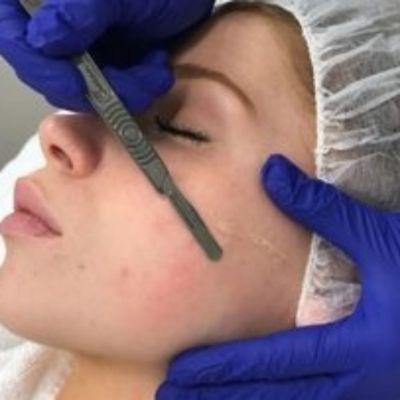 Dermaplaning