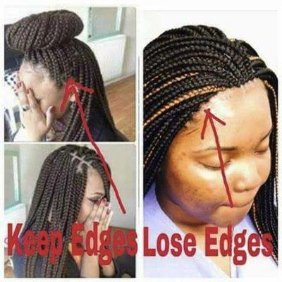 We care About Your Edges And Healthy Hair