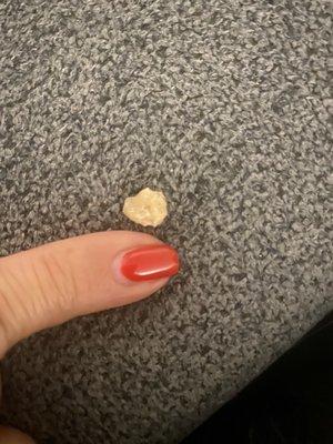 Cleaned it to check what it was an it was a piece of rock! That's my pinky to show size!!! ‍