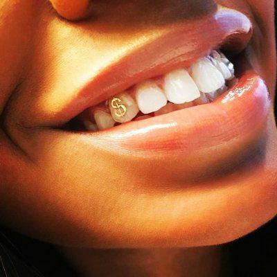 Teeth jewel placement will be added to our service center mid September!! BEAM and BLING, add a little sparkle to your bright smile.