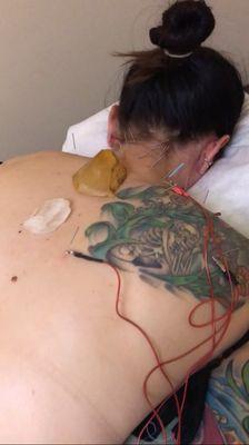 electro stem Acupuncture and healing crystals