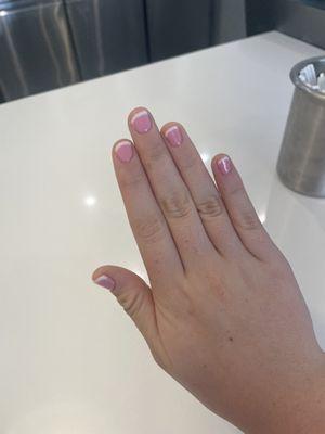 Gel set