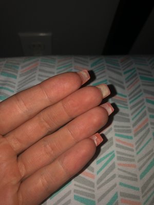 Crusty nails underneath that are not even glued to the acrylic