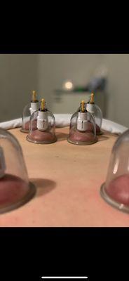 Cupping