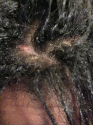 A week after my scalp is forming scabs from these dirty people. Don't go here They will give your healthy hair bacteria