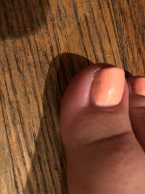 Toe nail.