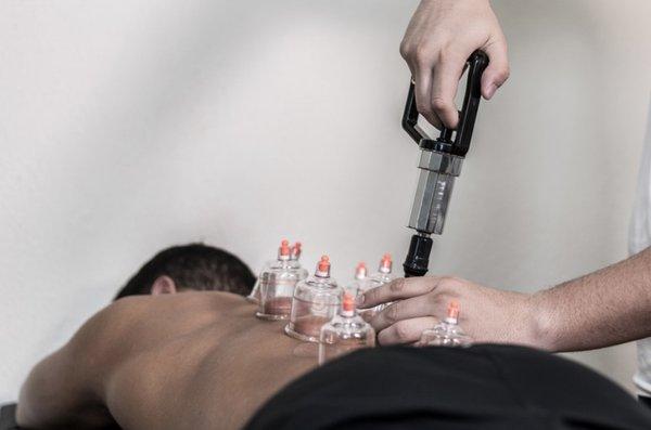 Cupping therapy added at no extra charge to any massage.