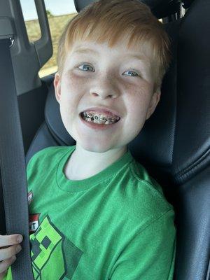 First part of Jackson's braces installed.